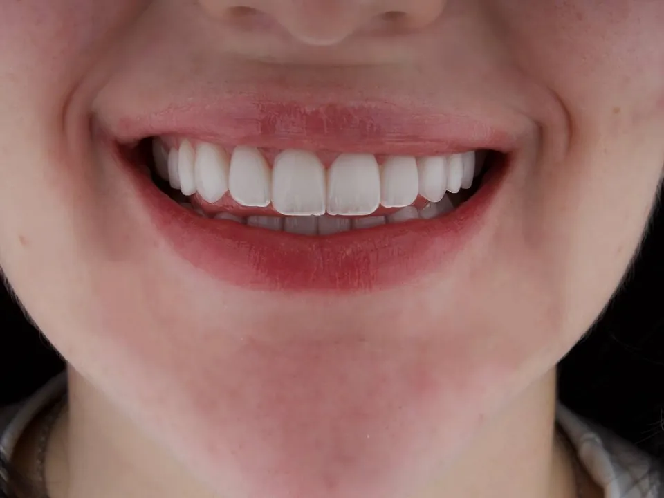 A subtle smile transformation that preserves natural character